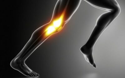 Runner con síndrome de la cintilla iliotibial (rodilla del corredor).