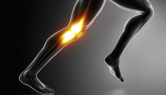 Runner con síndrome de la cintilla iliotibial (rodilla del corredor).